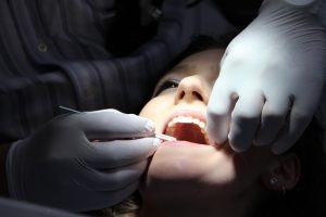 How to Become a Dental Assistant