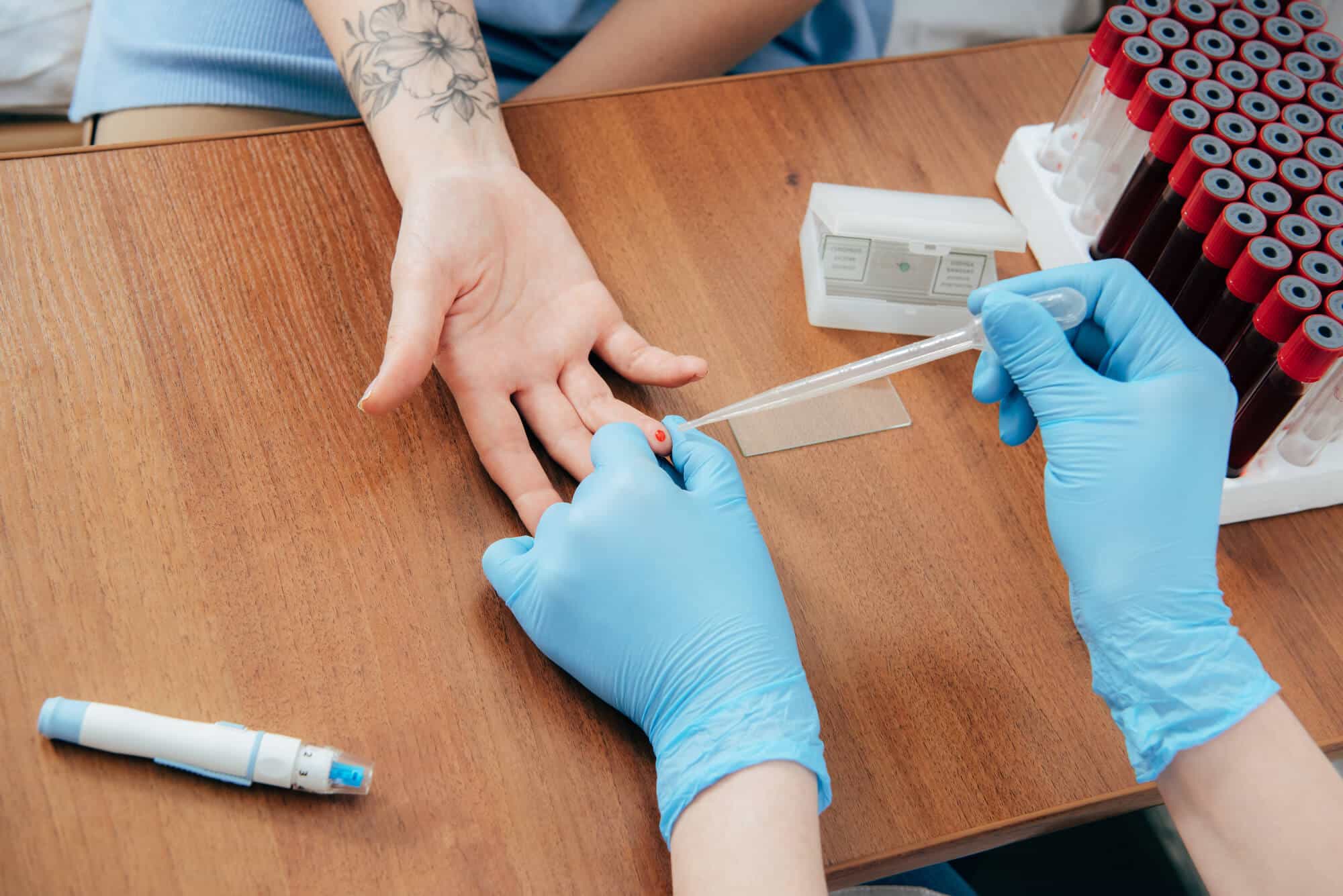 Phlebotomist drawing blood from a finger